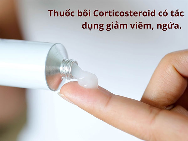 Corticoid dùng tại chỗ là lựa chọn phổ biến cho các đợt cấp viêm da cơ địa